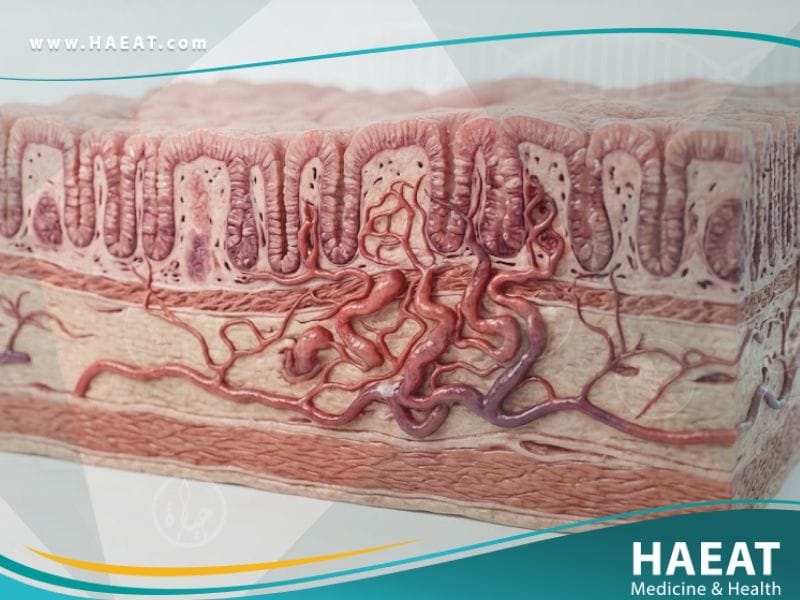 خلل التنسج الوعائي