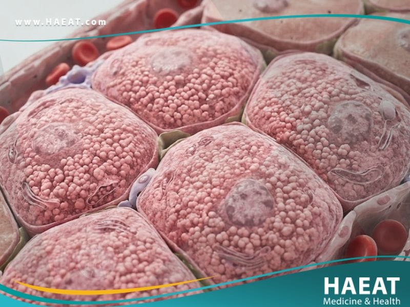 داء إختزان الغليكوجين