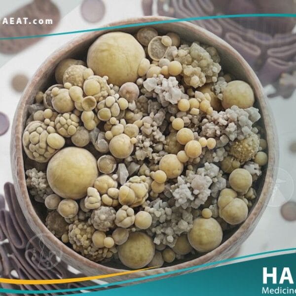 داء الاختزان في الجسيمات الحالة