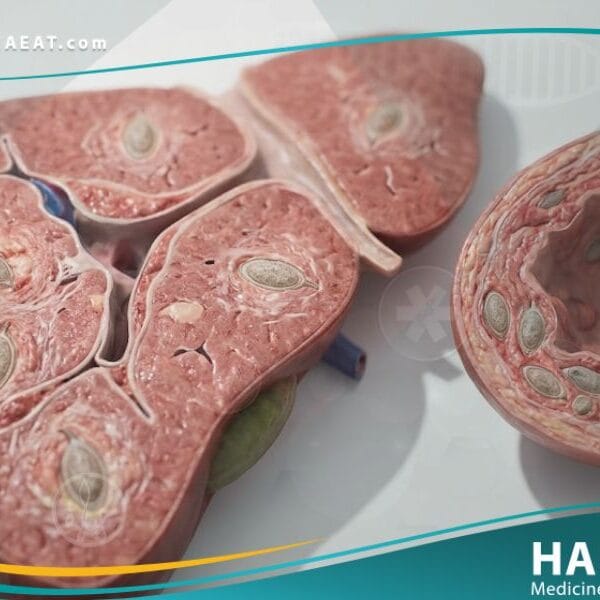 داء البلهارسيا