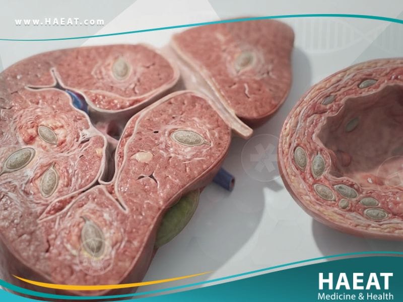 داء البلهارسيا