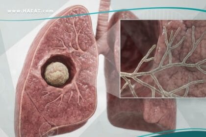 داء الرشاشيات