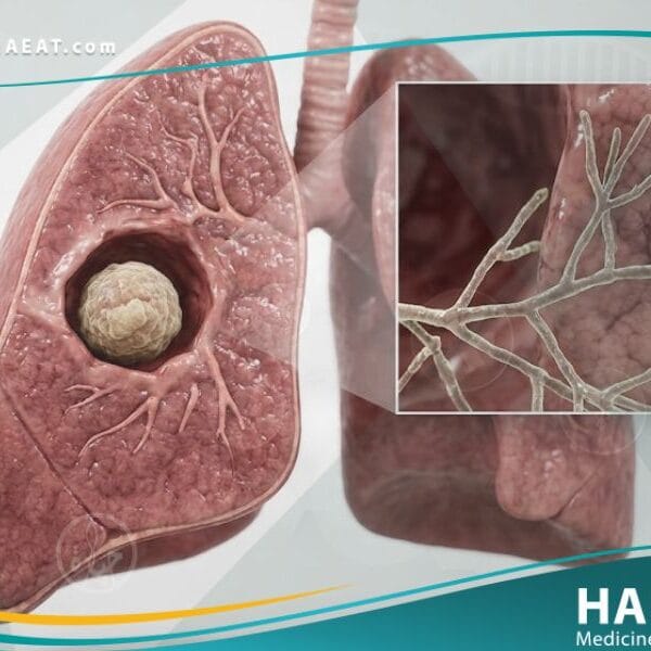 داء الرشاشيات