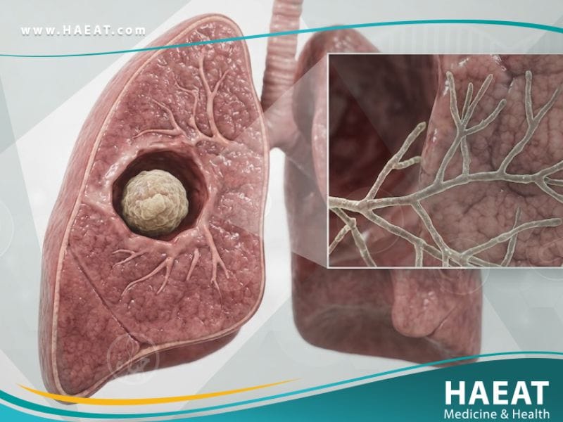 داء الرشاشيات