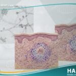 داء الشعريات المبوغة