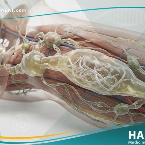 _داء الفيلاريات