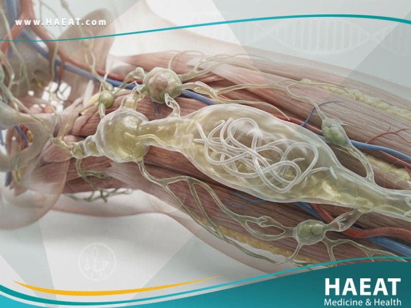 _داء الفيلاريات