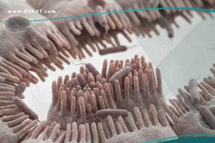 _داء الليستريات