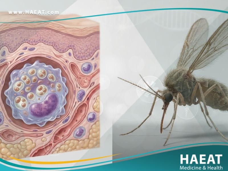 _داء الليشمانيات