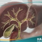 _داء المتورقات