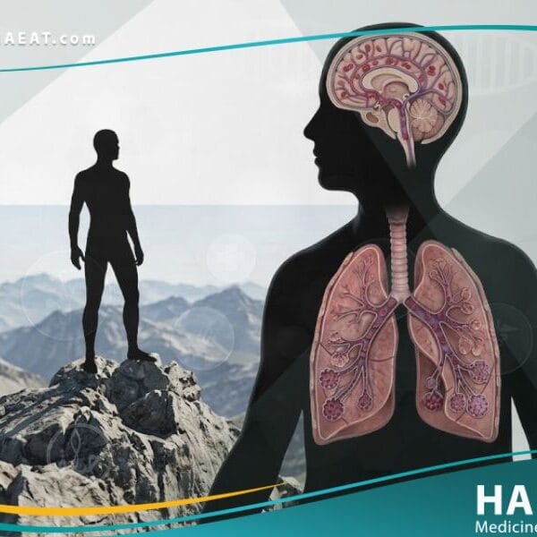 _داء المرتفعات