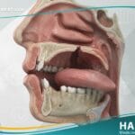 عيوب خلقية لجوف الفم