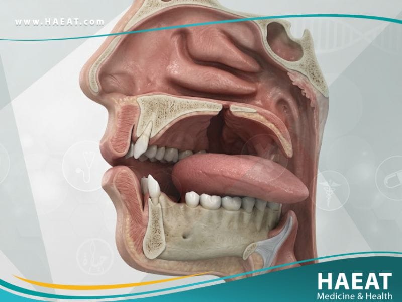 عيوب خلقية لجوف الفم