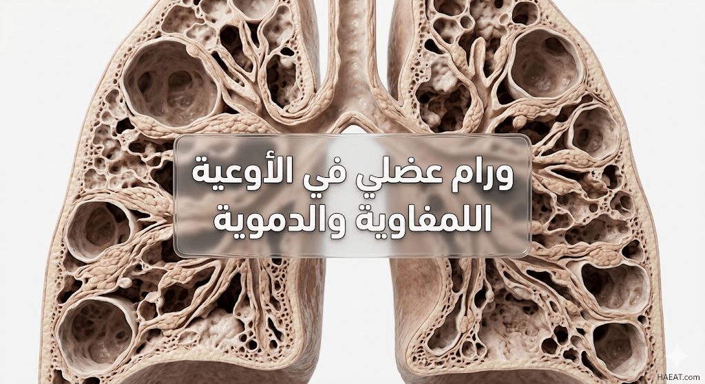 ورام عضلي في الأوعية اللمفاوية والدموية | 7 أعراض وأسباب 20 image 1332