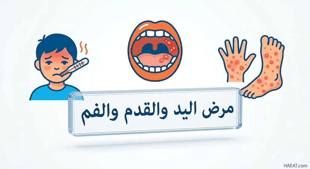 مرض اليد والقدم والفم | 5 حقائق عن التشخيص والوقاية 21 image 194