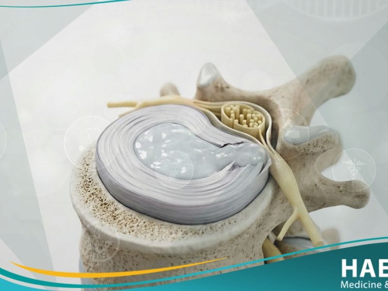 آلام أسفل الظهر