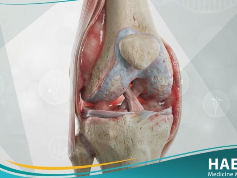 آلام المفاصل