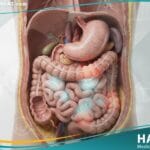 _ألم البطن عند الاطفال