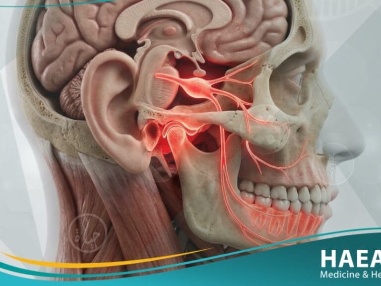 _ألم فموي وجهي