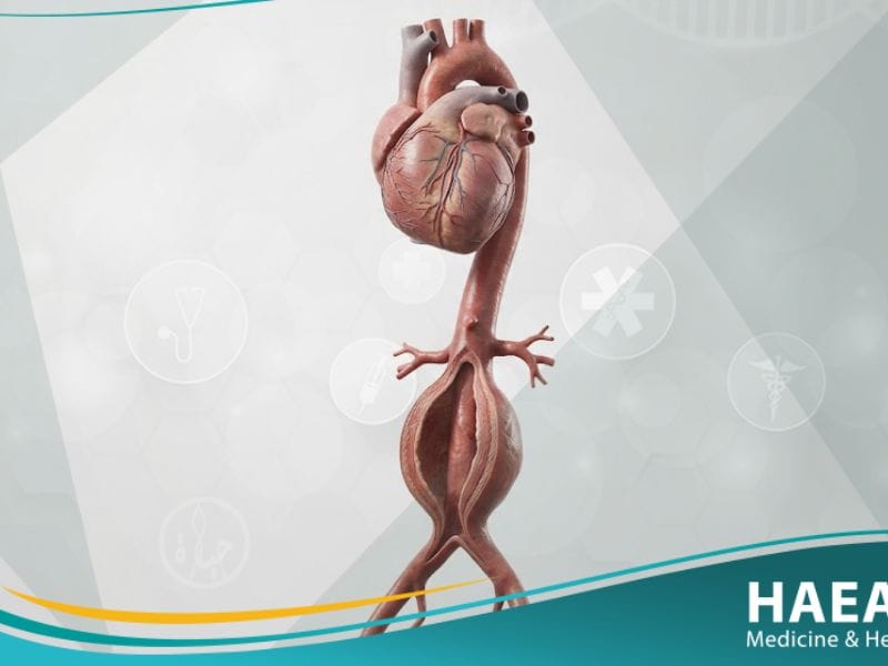 أم الدم الأبهرية