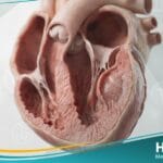 أم الدم البطينية اليسرى