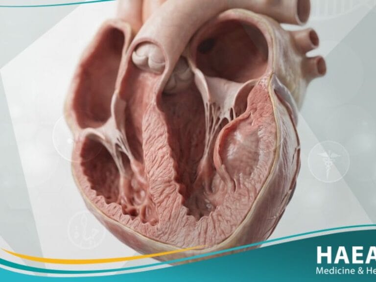 أم الدم البطينية اليسرى