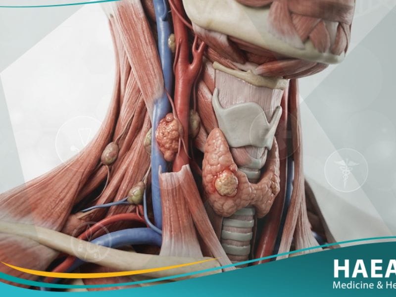 أورام أولية بالعنق