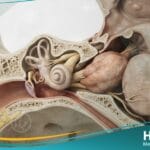 _أورام العصب السمعي