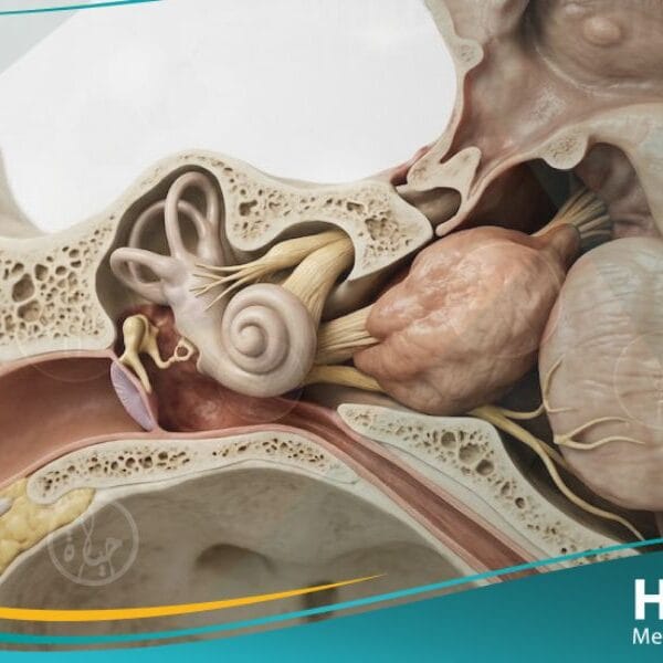 _أورام العصب السمعي