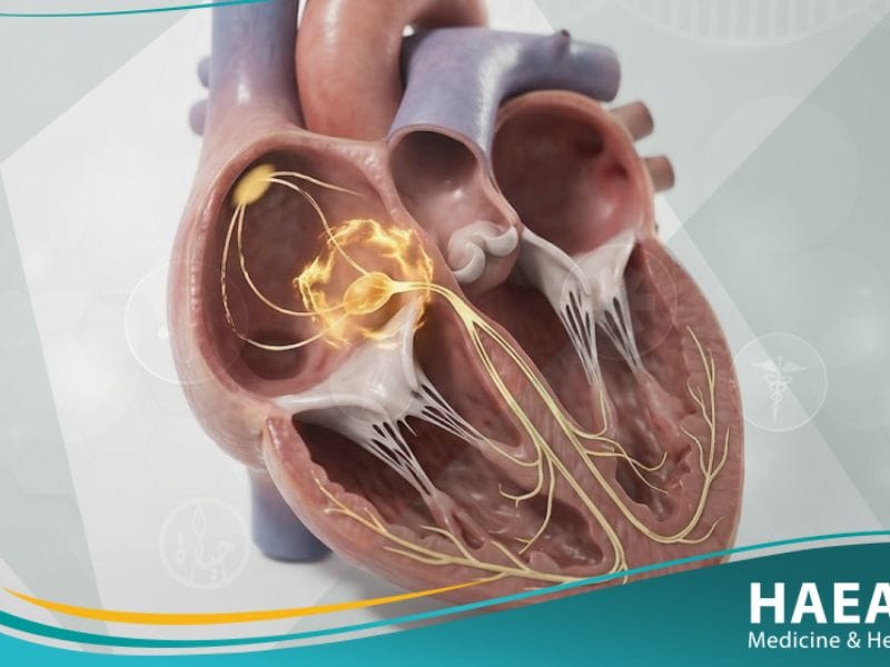 إحصار القلب