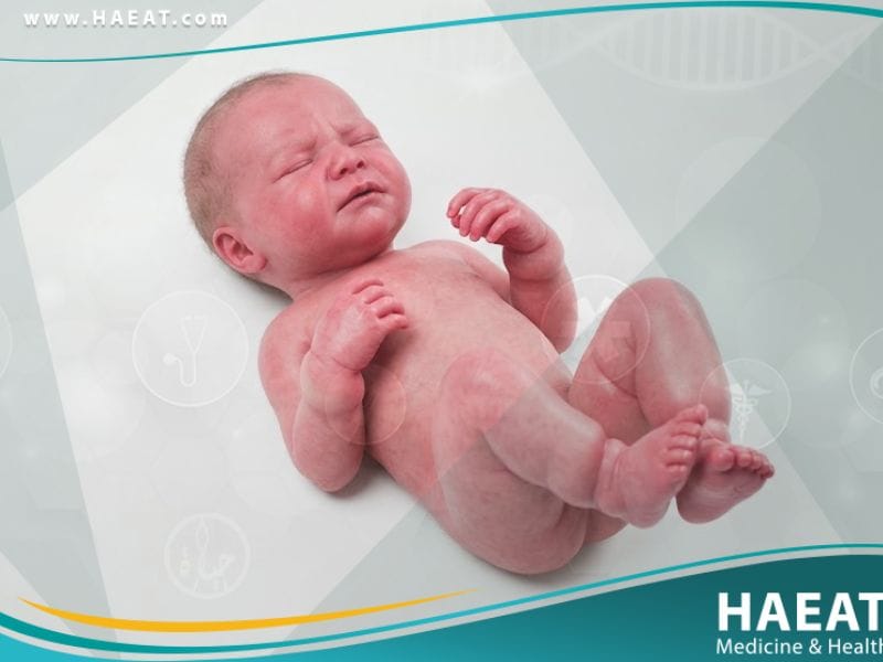 إصابة بردٍ وليدية