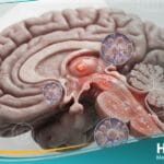 إلتهاب الدماغ الياباني