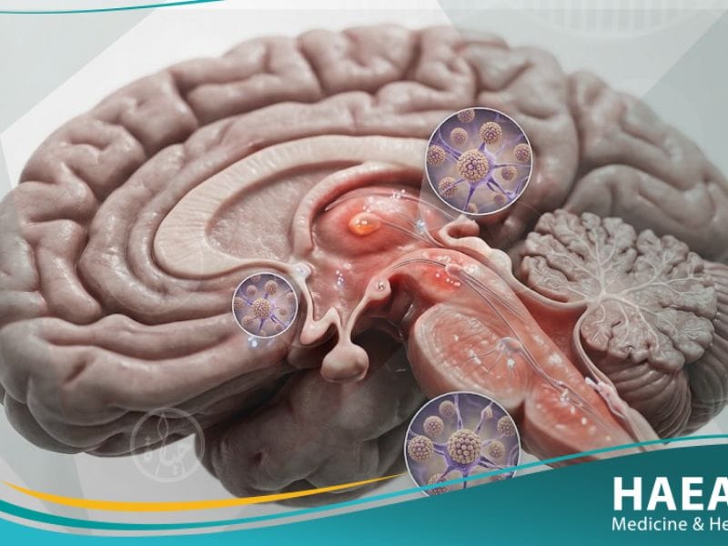 إلتهاب الدماغ الياباني