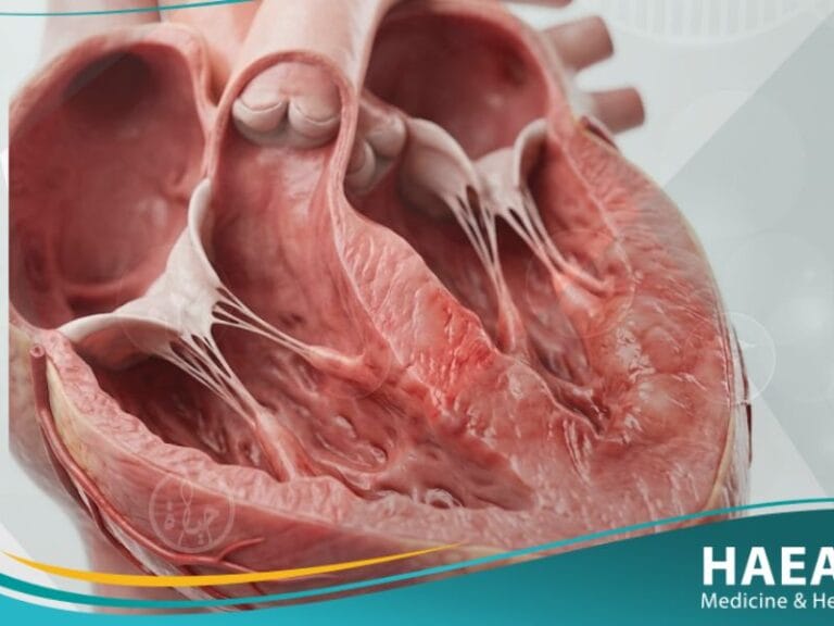 إلتهاب عضلة القلب