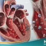 إنزيمات القلب