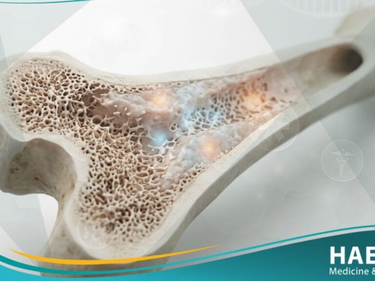 استسقاء العظم