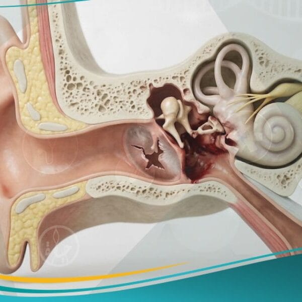 _اصابات الأذن