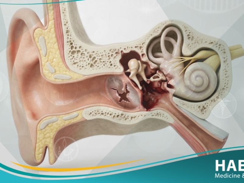 _اصابات الأذن