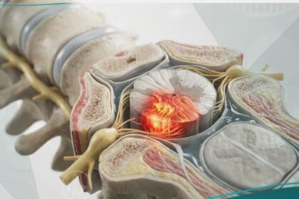 _اصابة النخاع الشوكي