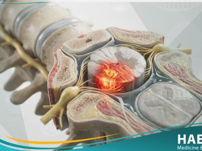 _اصابة النخاع الشوكي