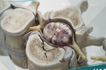 اصابة النخاع الشوكي