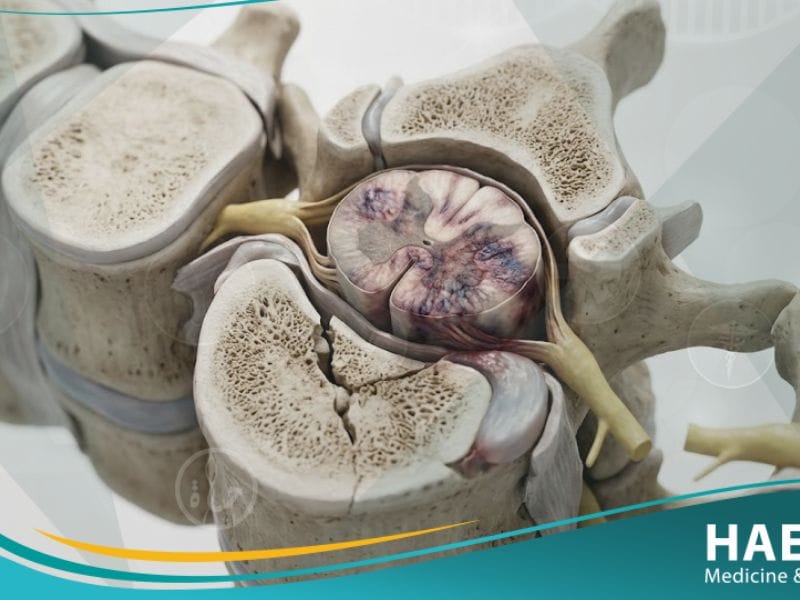 اصابة النخاع الشوكي