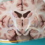 اضطرابات حركية