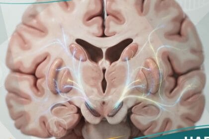 اضطرابات حركية