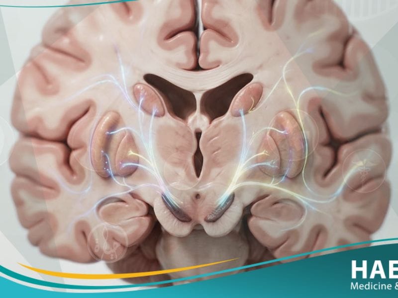 اضطرابات حركية