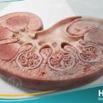 _اعتلال الكلية السكري