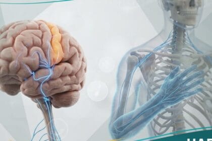 الآلام الشبحية