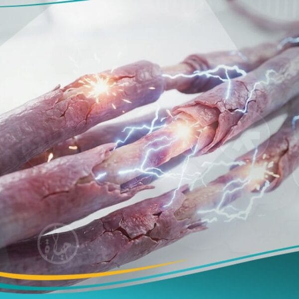 الألم العصبي (1)