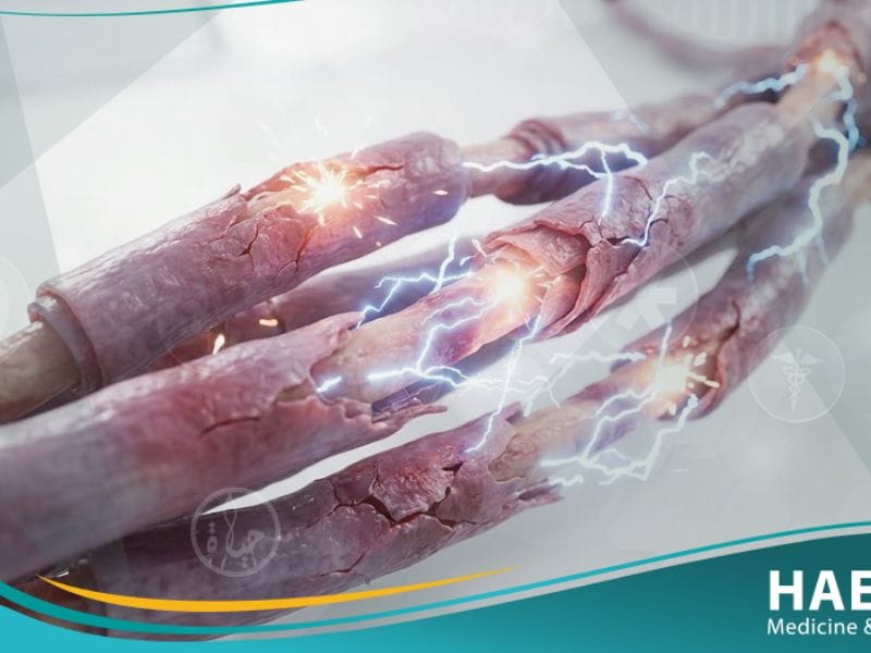 الألم العصبي (1)