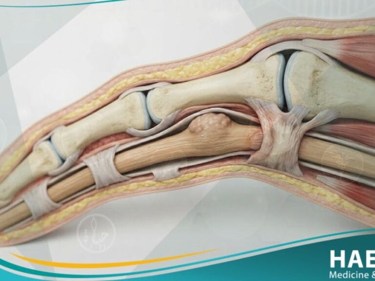 الإصبع الزنادية